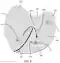 Fig. 06 - Automatic identification of abnormal LAT differences