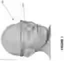 Fig. 02 - HEAD MOUNTABLE DEVICE