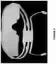 Fig. 07 - HEAD MOUNTABLE DEVICE