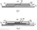 Fig. 07 - Bioimpedance measurement configuration
