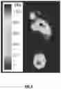 Fig. 09 - Custom foot orthotic and system and method for designing of a custom foot orthotic
