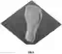 Fig. 10 - Custom foot orthotic and system and method for designing of a custom foot orthotic