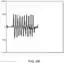 Fig. 15 - MOTION ANALYSIS SYSTEMS AND METHODS OF USE THEREOF