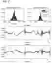 Fig. 18 - SYSTEMS AND METHODS OF AUTOMATIC COUGH IDENTIFICATION