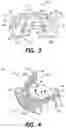 Fig. 04 - Intra-oral electroencephalography device and method