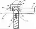 Fig. 01 - Methods and systems to measure and evaluate stability of medical implants
