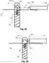 Fig. 25 - Methods and systems to measure and evaluate stability of medical implants