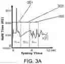 Fig. 04 - Apparatus and method for motor function characterization