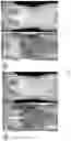 Fig. 05 - Systems and methods for estimating irradiation dose for patient application based on a radiation field model and a patient anatomy model