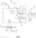 Fig. 02 - X-RAY SYSTEM FOR GUIDED OPERATION