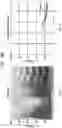 Fig. 17 - Apparatus and method for identification of wheezing in ausculated lung sounds