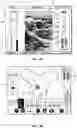 Fig. 04 - Systems and Methods for Infrared-Enhanced Ultrasound Visualization