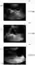 Fig. 05 - SYSTEM AND METHOD FOR ASSESSING OBSTETRIC WELLBEING