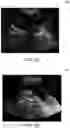 Fig. 06 - SYSTEM AND METHOD FOR ASSESSING OBSTETRIC WELLBEING
