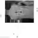 Fig. 11 - Methods and apparatuses for guiding collection of ultrasound data using motion and/or orientation data