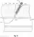 Fig. 06 - Suturing devices and methods