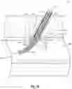 Fig. 09 - Suturing devices and methods