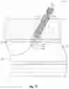 Fig. 11 - Suturing devices and methods