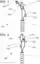 Fig. 02 - Interventional device for specimen retrieval