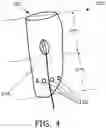 Fig. 04 - Interventional device for specimen retrieval