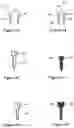 Fig. 11 - Bone distractor