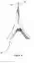 Fig. 17 - Bone distractor