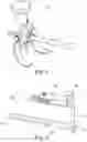 Fig. 03 - Method and apparatus for joint reconstruction