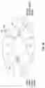 Fig. 03 - Mitral papillary muscle exposure device