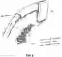 Fig. 06 - Mitral papillary muscle exposure device