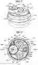 Fig. 02 - Methods and devices for providing access into a body cavity