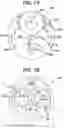 Fig. 06 - Methods and devices for providing access into a body cavity