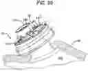 Fig. 14 - Methods and devices for providing access into a body cavity