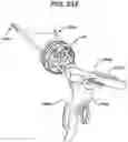 Fig. 19 - Methods and devices for providing access into a body cavity