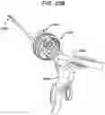 Fig. 20 - Methods and devices for providing access into a body cavity