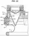 Fig. 30 - Methods and devices for providing access into a body cavity
