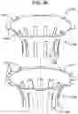 Fig. 37 - Methods and devices for providing access into a body cavity