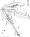 Fig. 05 - Prosthetic suturing device and methods thereof