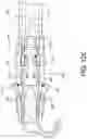 Fig. 16 - Prosthetic suturing device and methods thereof