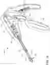 Fig. 20 - Prosthetic suturing device and methods thereof