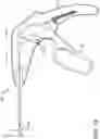 Fig. 22 - Prosthetic suturing device and methods thereof