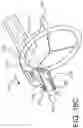 Fig. 25 - Prosthetic suturing device and methods thereof