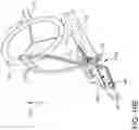 Fig. 27 - Prosthetic suturing device and methods thereof