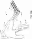 Fig. 30 - Prosthetic suturing device and methods thereof