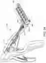 Fig. 34 - Prosthetic suturing device and methods thereof