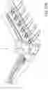 Fig. 40 - Prosthetic suturing device and methods thereof