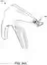 Fig. 55 - Prosthetic suturing device and methods thereof