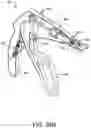Fig. 56 - Prosthetic suturing device and methods thereof