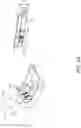 Fig. 65 - Prosthetic suturing device and methods thereof