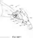 Fig. 68 - Prosthetic suturing device and methods thereof