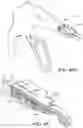 Fig. 69 - Prosthetic suturing device and methods thereof